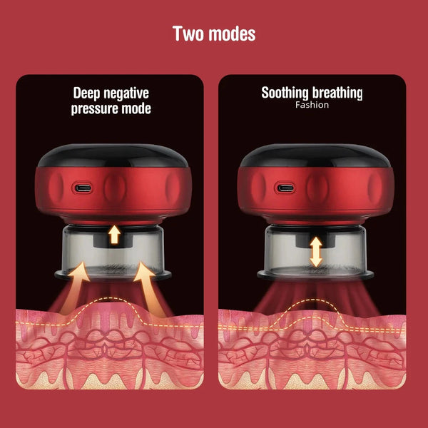 Intelligent Vacuum Cupping Massage Device Electric Heating DealNede™