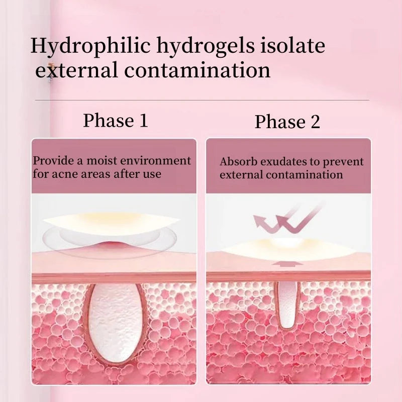 Hydrocolloid Acne Patch – Invisible Waterproof Pimple Cover DealNede™