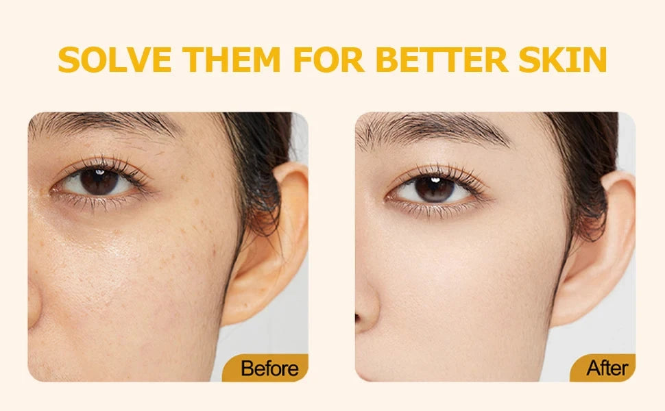 Deep Vitamin C Golden Capsule Hydrating Face Moisturizer DealNede™