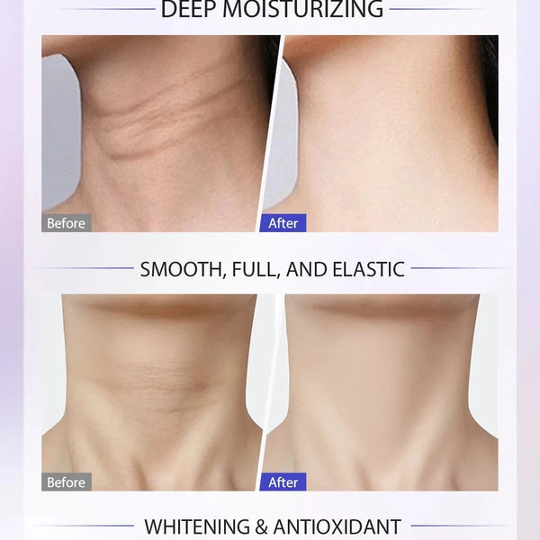 Collagen Neck Cream Lifting Tightening Anti Wrinkle Skin Care DealNede™
