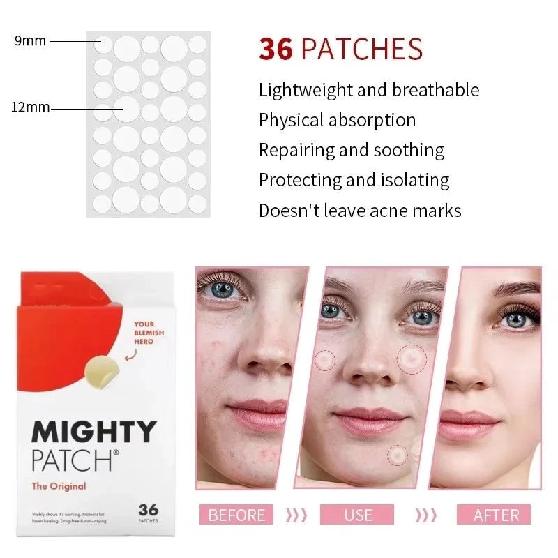 Hydrocolloid Acne Patch – Invisible Waterproof Pimple Cover DealNede™