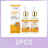 Turmeric Skincare Set Brightening Anti Acne Face and Body Care DealNede™