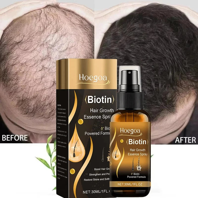 Biotin Fast Hair Growth Spray Anti Hair Loss Serum Prevent Baldness Treatment Scalp Beard Beauty Essence Hair Care Products 30ml DealNede™